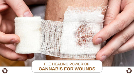 The Healing Power of Cannabis for Wounds - Hemspot